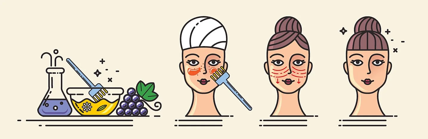 Ilustração do Peeling antes e depois