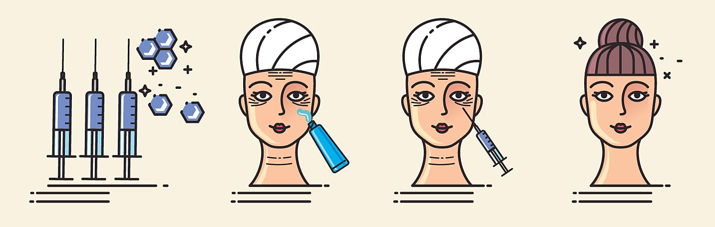 Como ocorre o Preenchimento Facial