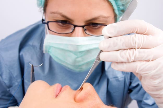 Entenda como funciona a rinoplastia