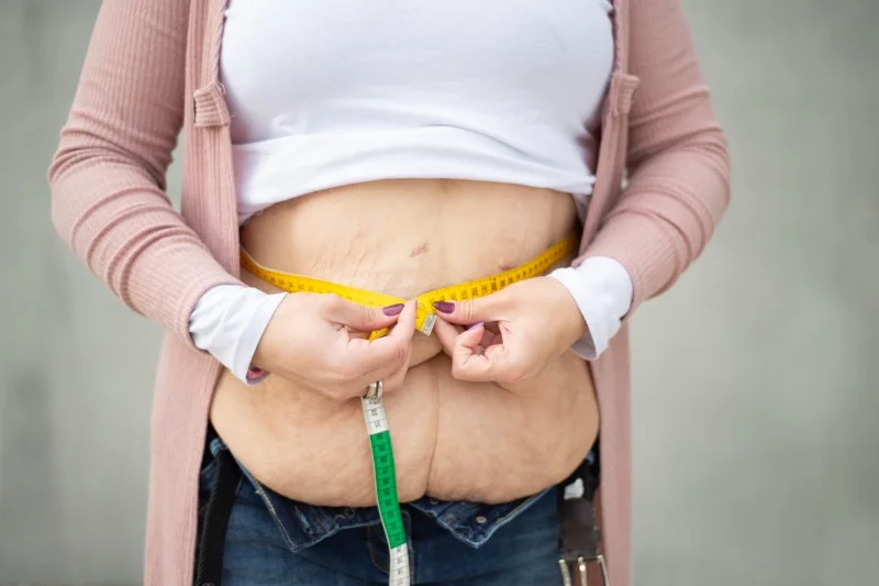 Grávidas com bariátrica precisam de algum cuidado especial?