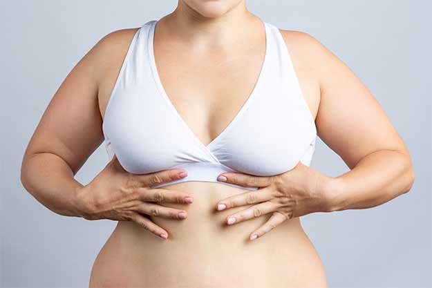 mulher candidata à cirurgia pós-bariátrica de mamas