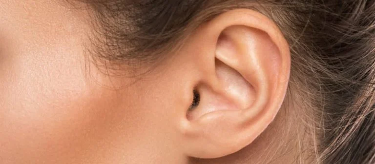 Orelha após o procedimento de cirurgia de reconstrução de orelha