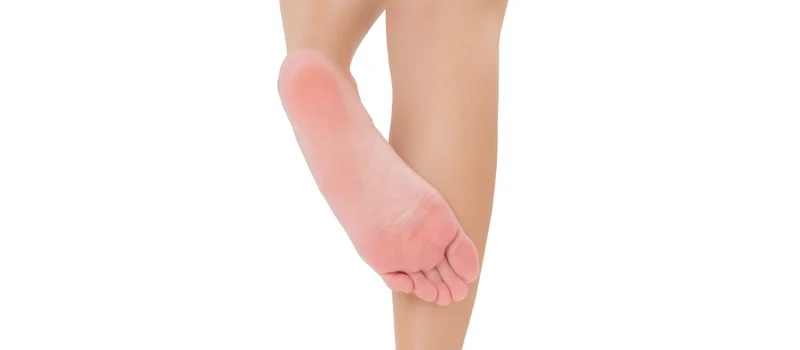 paciente mostrando a cirurgia de tratamento do pé do diabético