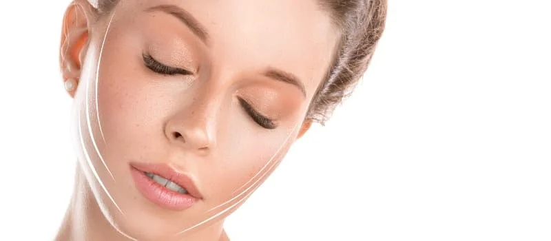 Paciente mostrando o resultado da blefaroplastia com midface lift (Lifting de pálpebras)