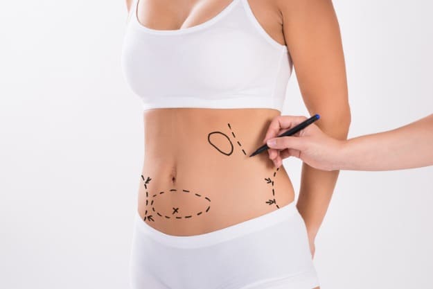 como é feita abdominoplastia