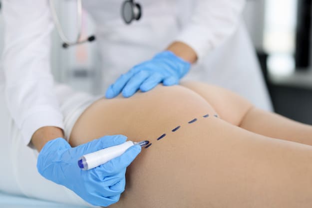 mulher realizando cirurgia plástica nos glúteos