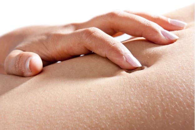 indicações da onfaloplastia