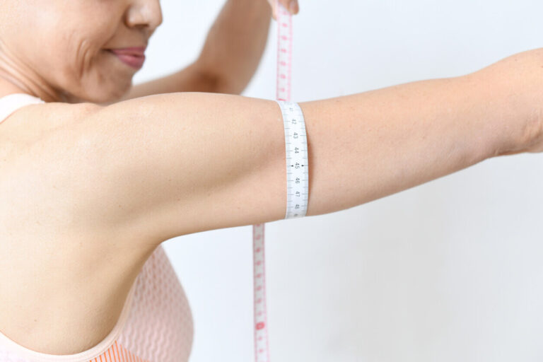 Pessoa medindo o braço com fita métrica, sinalizando preocupação com braços flácidos e excesso de pele na região.