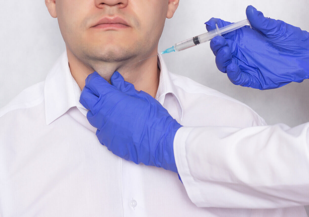 Profissional aplicando anestesia ou medicamento na região abaixo do queixo de um paciente, representando o preparo para o procedimento de lipoaspiração de papada.