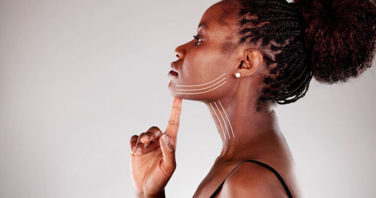 Mulher apontando para a região do pescoço com linhas ilustrativas, representando os efeitos do lifting de pescoço para reduzir a papada e redefinir o contorno facial