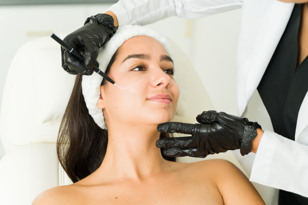 Paciente sendo preparada para marcação pré-operatória em uma técnica de lifting facial no estilo Deep Plane, com a cirurgiã delineando as áreas de tratamento no rosto.