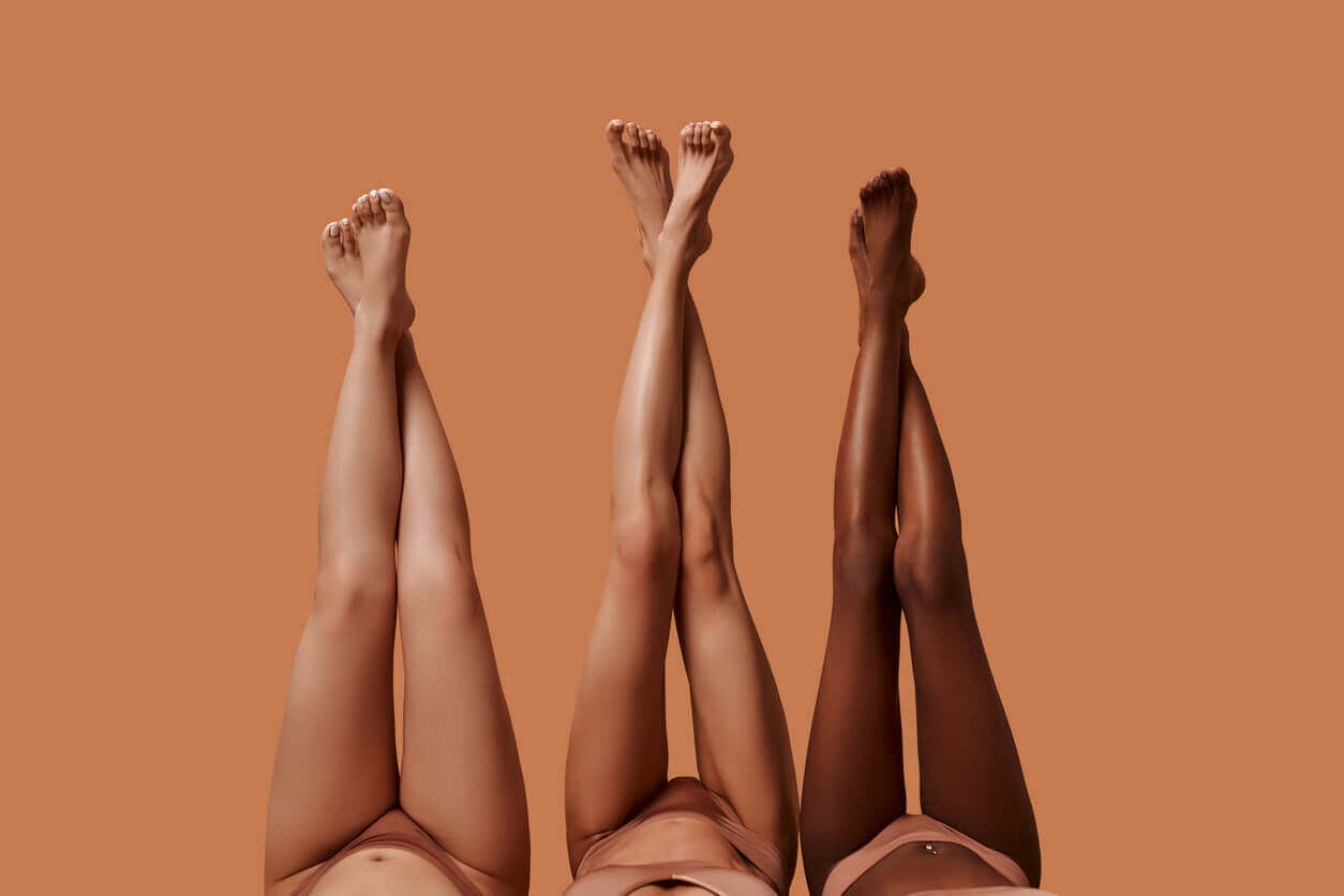 Pernas femininas levantadas com diferentes tons de pele ilustrando a dúvida se lipedema é hereditario e o papel da genética na doença