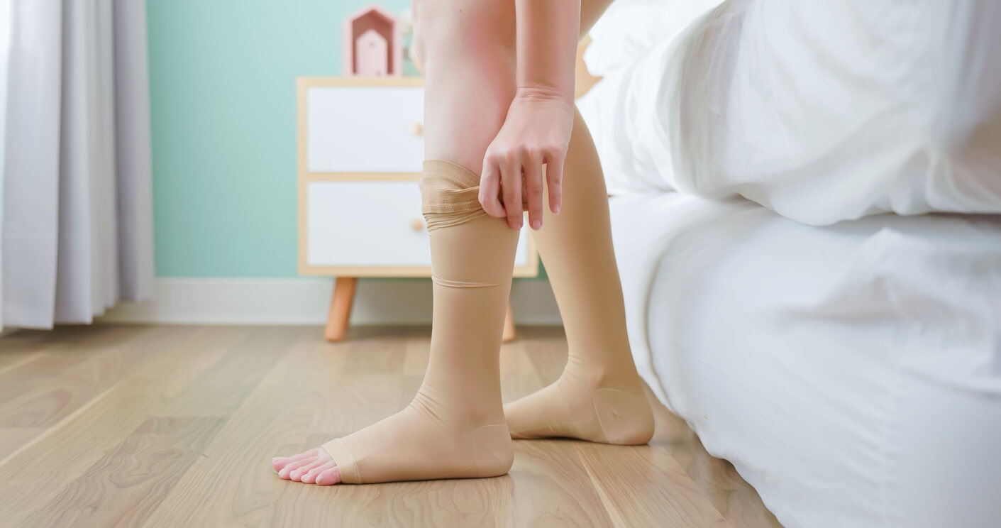 Uso de meia de compressão nas pernas como estratégia de como desinflamar o lipedema, ajudando a reduzir inchaço e desconforto