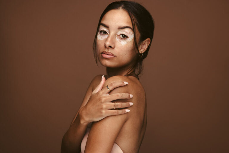 Mulher com aparência rejuvenescida em fundo neutro, representando resultado lifting facial harmonioso e natural.