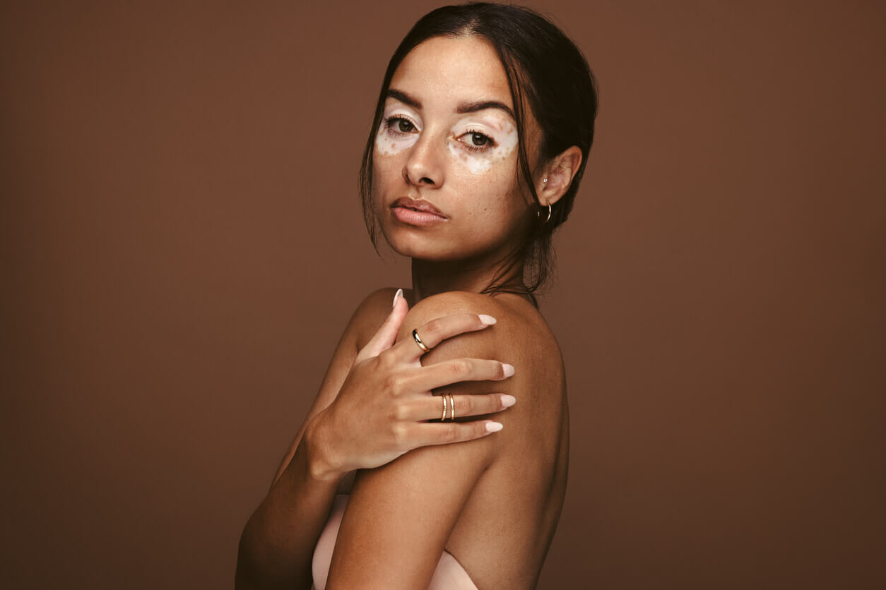 Mulher com aparência rejuvenescida em fundo neutro, representando resultado lifting facial harmonioso e natural.