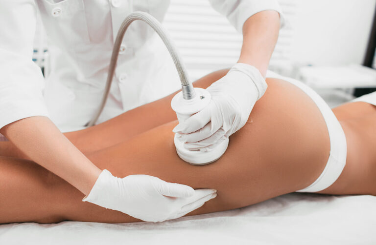 Profissional realizando tratamento corporal na perna de paciente, representando cuidados associados à drenagem para lipedema.