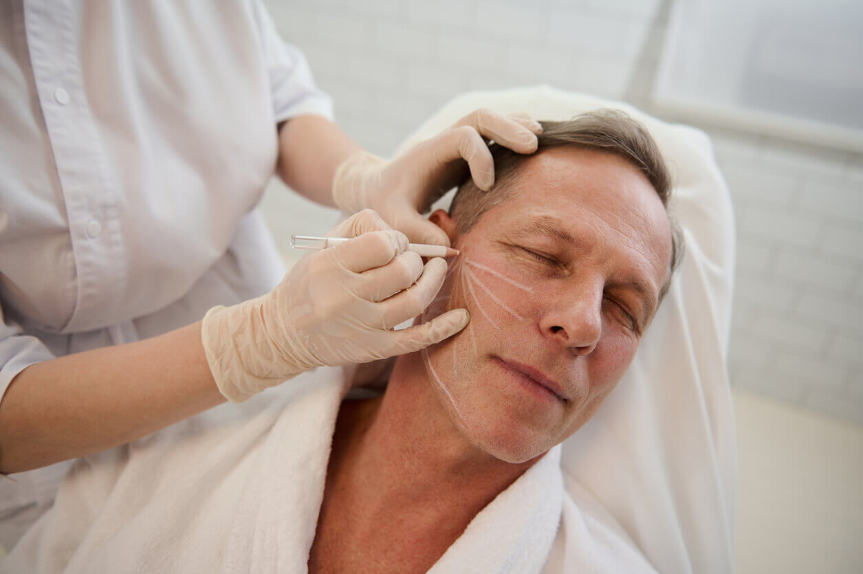 Homem realizando marcação facial para cirurgia deep plane em clínica estética.