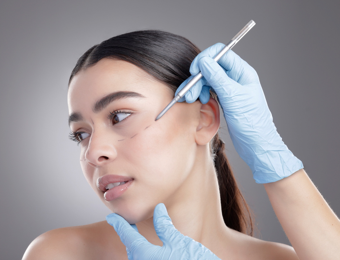 Mulher durante avaliação para microlifting, com marcações no rosto para planejamento do procedimento de rejuvenescimento facial.