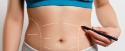 como funciona a abdominoplastia