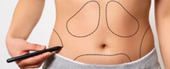 abdominoplastia pós-bariátrica