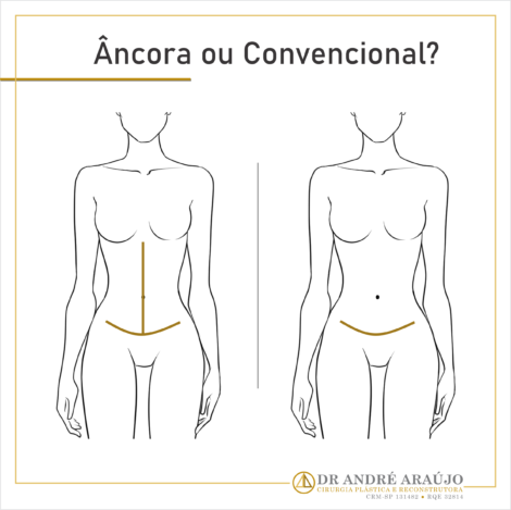 Dr André Araújo • Cirurgia Plástica e Pós-Bariátrica • Saiba como a  drenagem linfática facial pode ajudar seu pós-operatório
