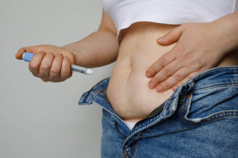 Pessoa segurando uma caneta emagrecedora próxima ao abdômen com flacidez, ilustrando a busca por cirurgia reparadora pós emagrecimento após perda de peso rápida