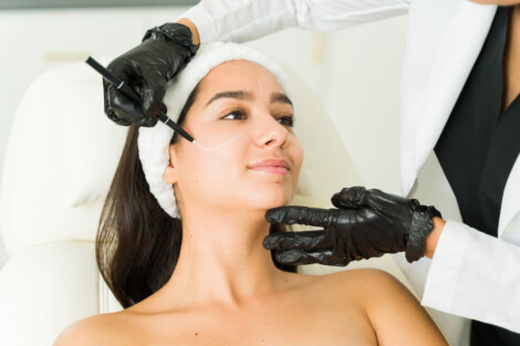 Paciente sendo preparada para marcação pré-operatória em uma técnica de lifting facial no estilo Deep Plane, com a cirurgiã delineando as áreas de tratamento no rosto.