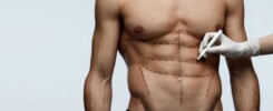 lipo hd masculina resultados