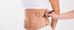 momento certo para fazer abdominoplastia