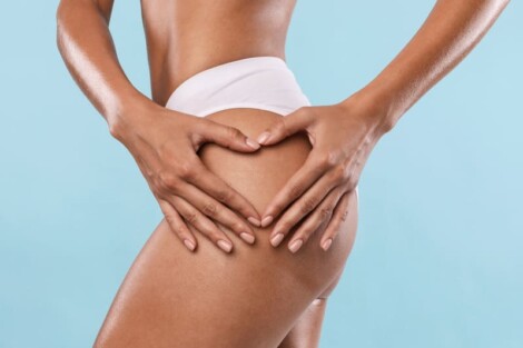 tendncias da gluteoplastia