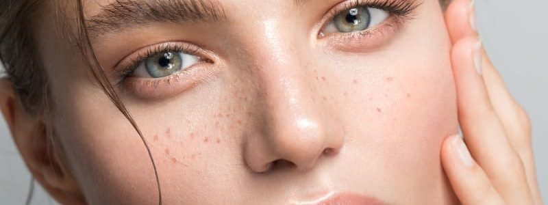 Plástica de lipoenxertia facial em São Paulo