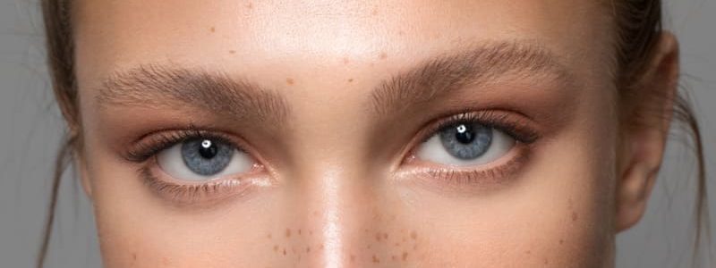 Mulher após blefaroplastia