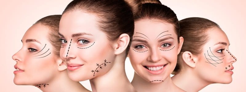 cirurgia para colocar próteses faciais