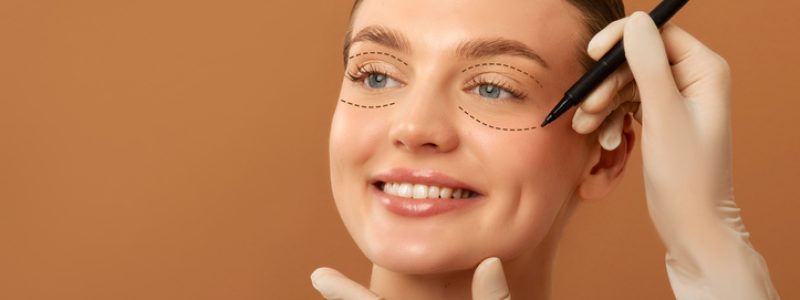 Mulher em avaliação para realizar o deep plane facelift