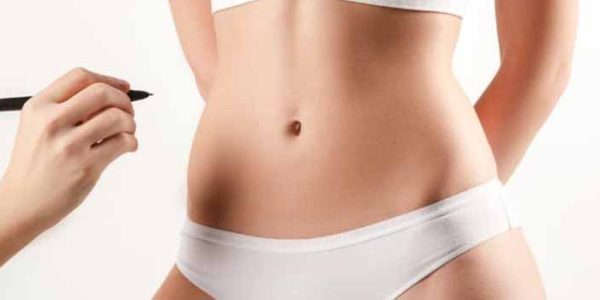 Onfaloplastia ou cirurgia plástica do umbigo