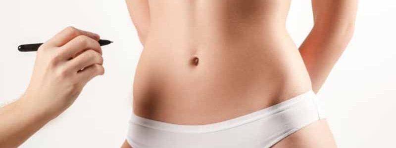 Onfaloplastia ou cirurgia plástica do umbigo